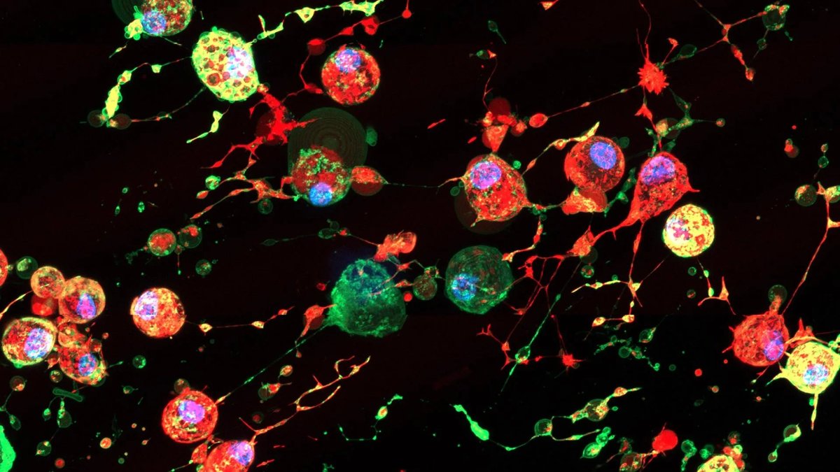 Fluorescent microscopy image showing apoptotic extracellular vesicles from dying cells