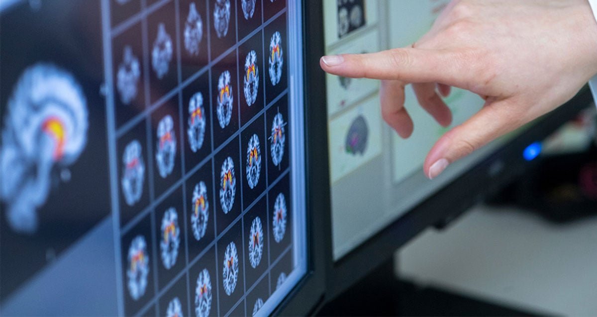Analysis of brain scans obtained using fMRI (representative image)