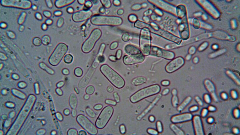 Close-up image of rod-shaped bacteria under a microscope, showcasing microscopic detail