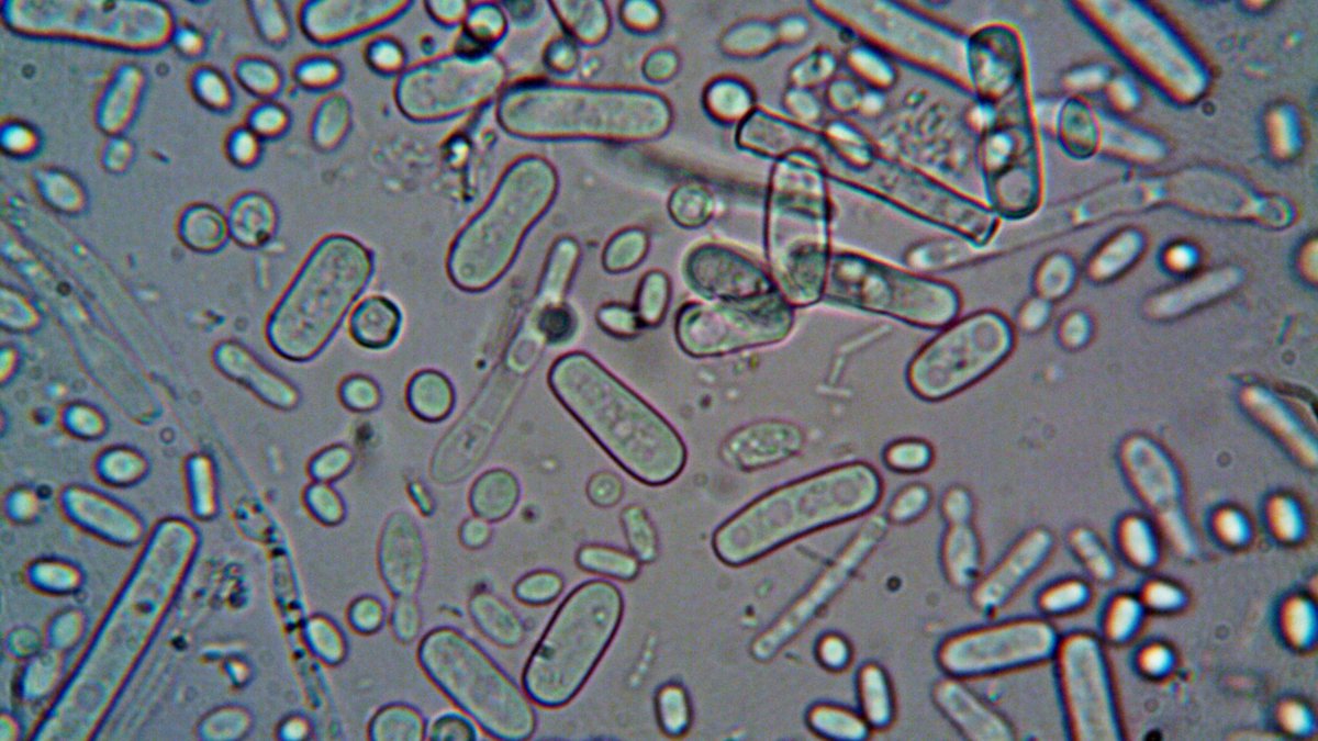 Close-up image of rod-shaped bacteria under a microscope, showcasing microscopic detail