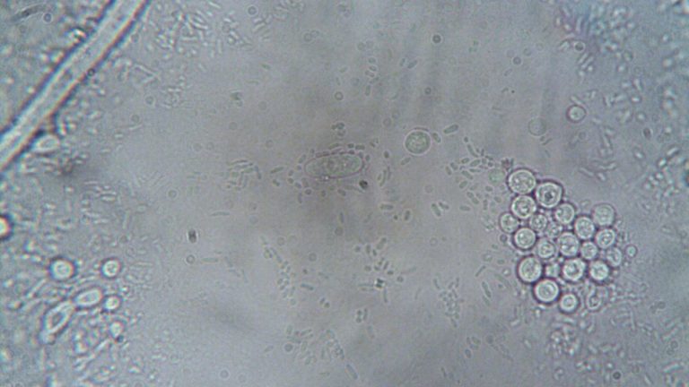 Cellular senescence microscope image