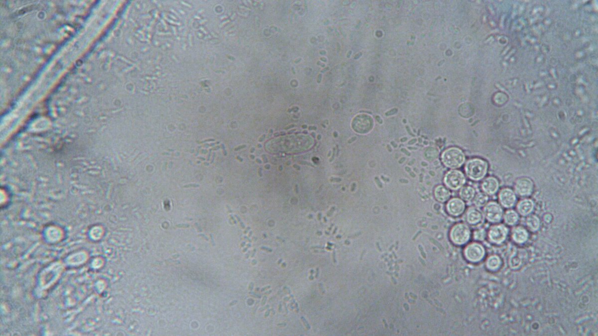 Cellular senescence microscope image
