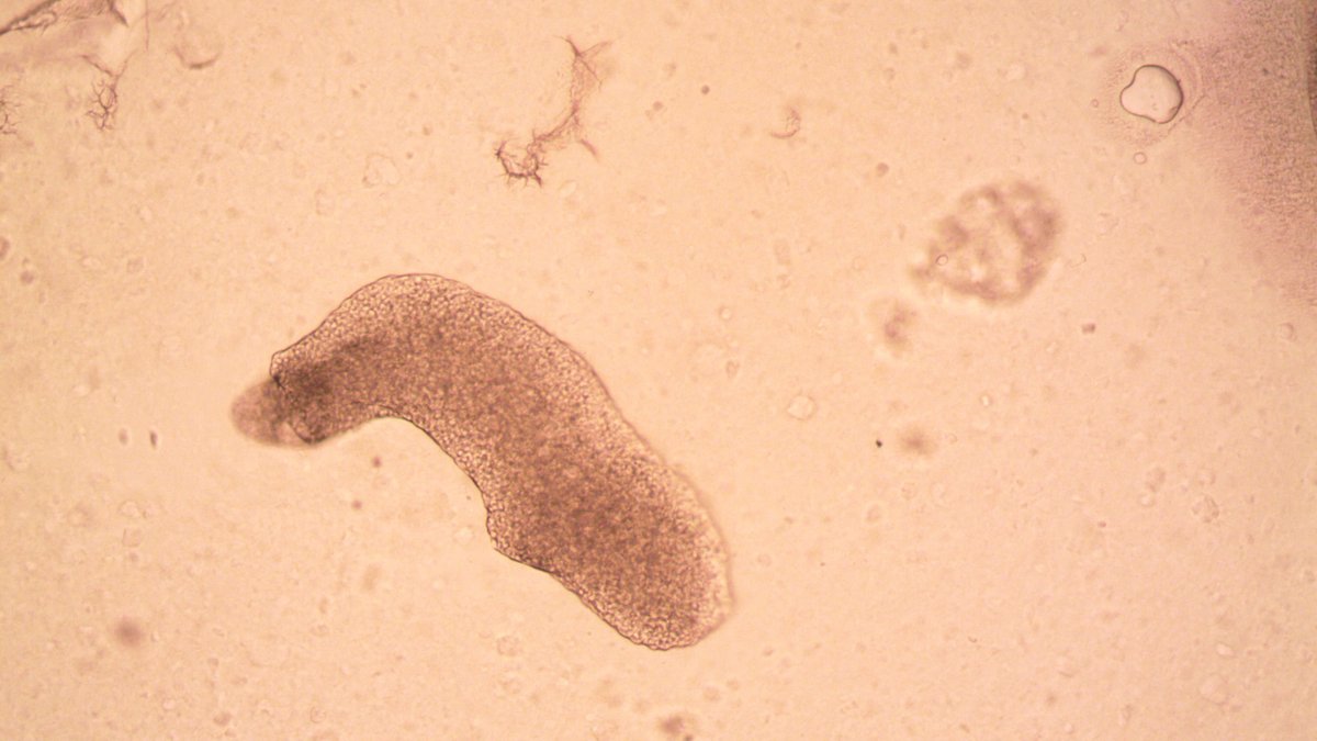 Tardigrade microscope