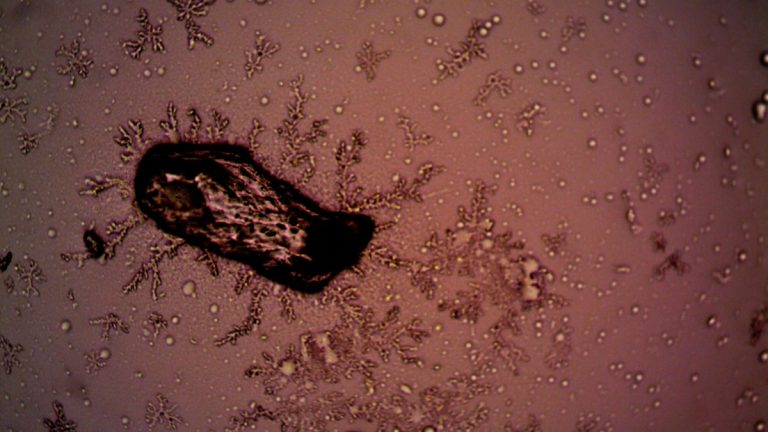 Close-up of bacteria and crystal formations under a microscope, displaying intricate patterns