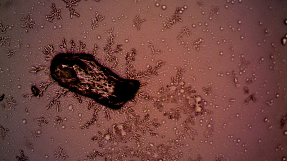 Close-up of bacteria and crystal formations under a microscope, displaying intricate patterns