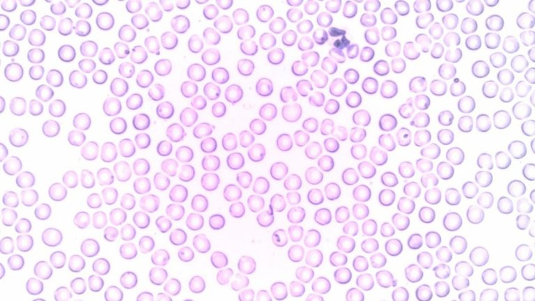 Microscopic white blood cell illustration representing immune defense