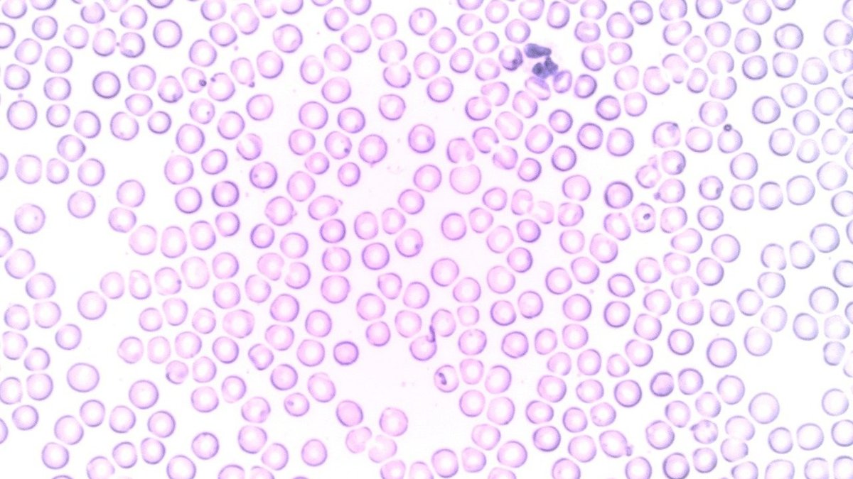 Microscopic white blood cell illustration representing immune defense