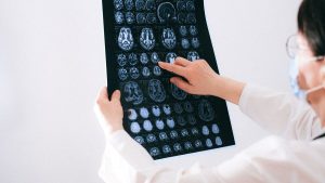 Doctor examines brain MRI scans closely for medical diagnosis in a hospital environment
