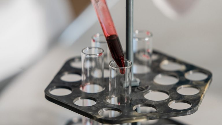 Astronaut blood protein analysis