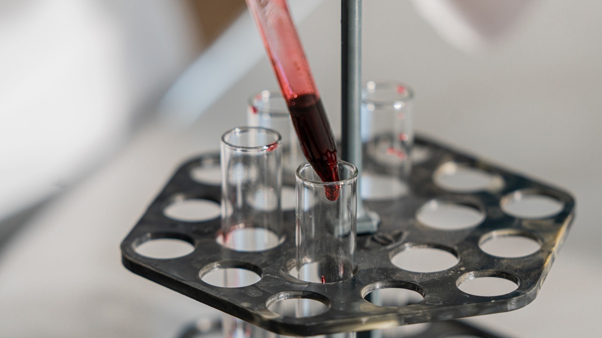 Astronaut blood protein analysis
