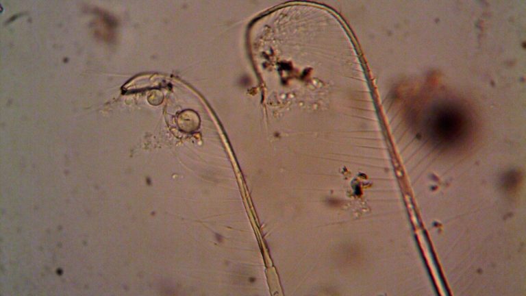 Marine_plankton_seen_under_a_microscope