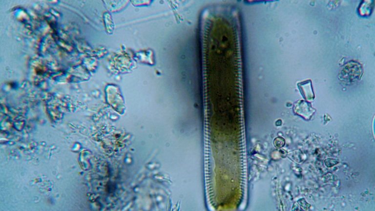 Detailed image of a diatom viewed through a microscope, showcasing cellular structure