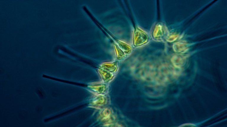 Marine phytoplankton viewed through a microscope
