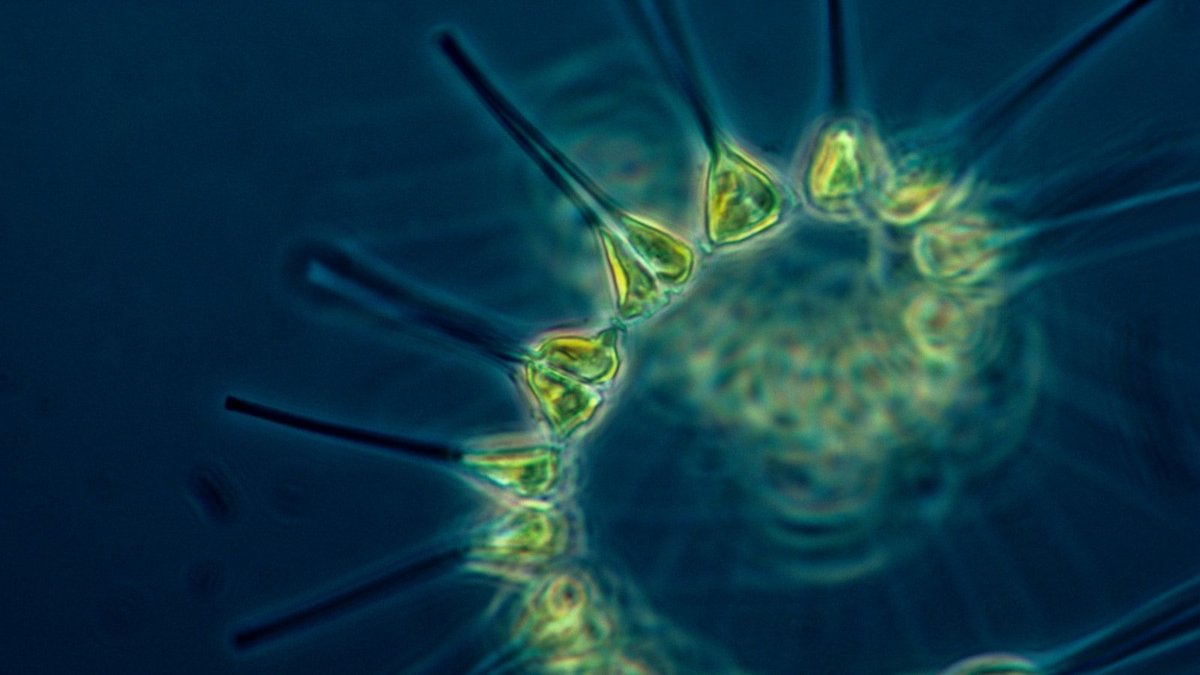 Marine phytoplankton viewed through a microscope